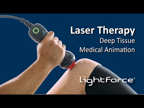 Laser Therapy - Deep Tissue Medical Animation